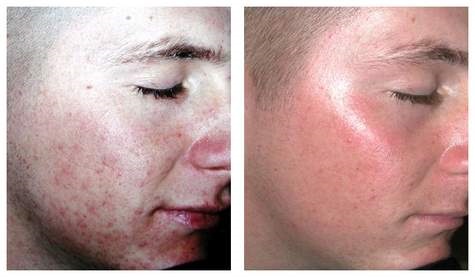 SKIN MED Laser Clinic TORONTO - Wrinkles | Brown Spots